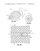 SPINAL IMPLANTS AND METHODS diagram and image