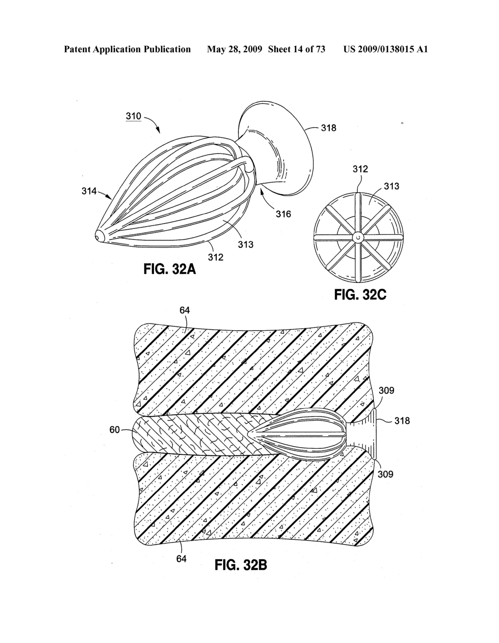 SPINAL IMPLANTS AND METHODS - diagram, schematic, and image 15