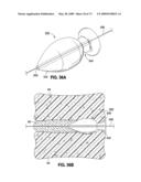 SPINAL IMPLANTS AND METHODS diagram and image