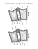 SPINAL IMPLANTS AND METHODS diagram and image