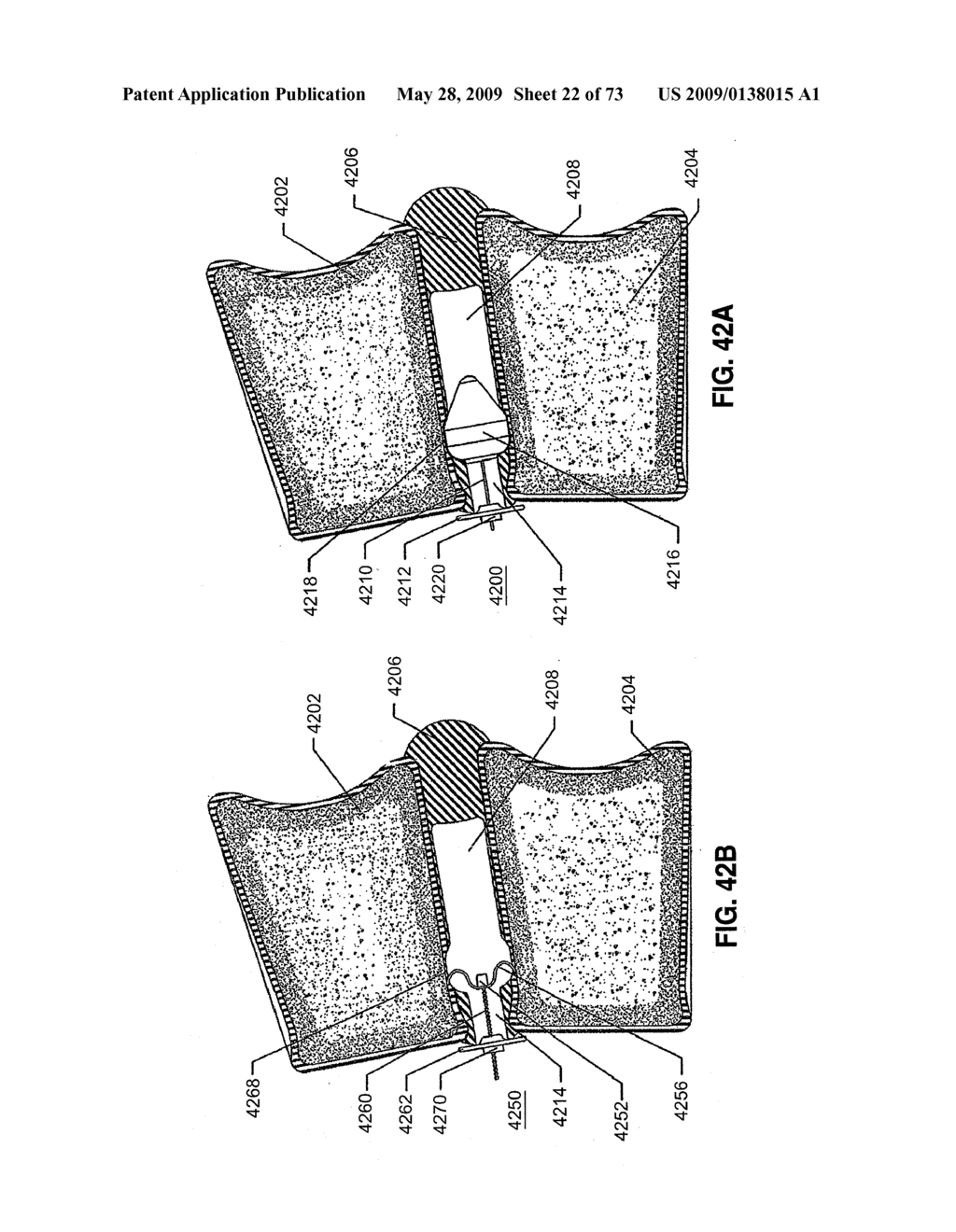 SPINAL IMPLANTS AND METHODS - diagram, schematic, and image 23