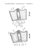 SPINAL IMPLANTS AND METHODS diagram and image