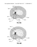 SPINAL IMPLANTS AND METHODS diagram and image