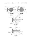 SPINAL IMPLANTS AND METHODS diagram and image