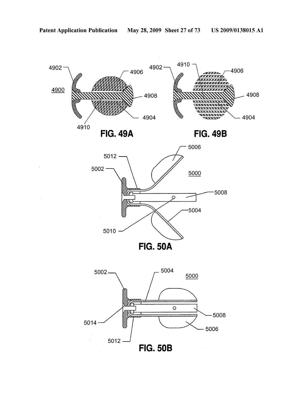 SPINAL IMPLANTS AND METHODS - diagram, schematic, and image 28