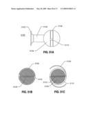 SPINAL IMPLANTS AND METHODS diagram and image