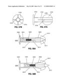 SPINAL IMPLANTS AND METHODS diagram and image