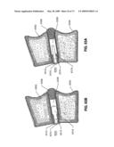 SPINAL IMPLANTS AND METHODS diagram and image