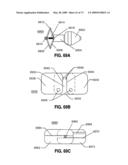 SPINAL IMPLANTS AND METHODS diagram and image