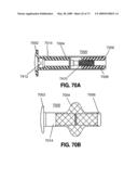 SPINAL IMPLANTS AND METHODS diagram and image