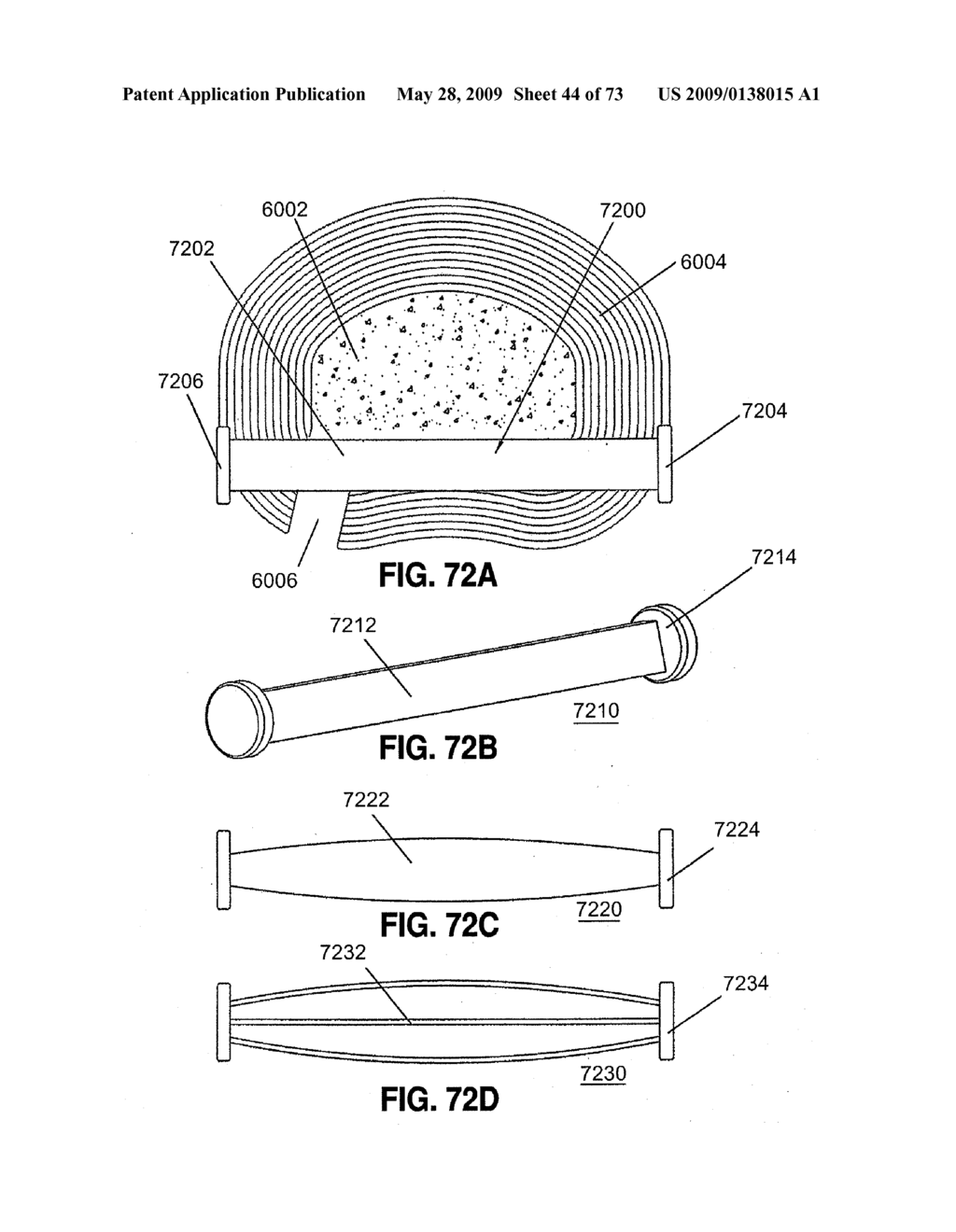 SPINAL IMPLANTS AND METHODS - diagram, schematic, and image 45