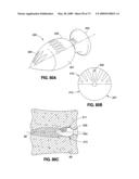 SPINAL IMPLANTS AND METHODS diagram and image