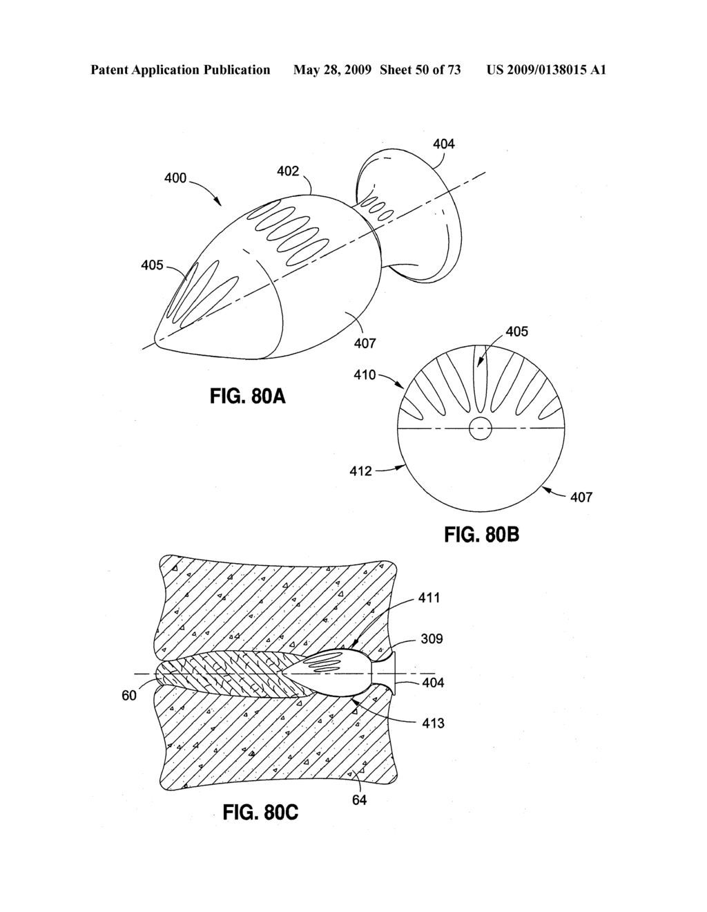 SPINAL IMPLANTS AND METHODS - diagram, schematic, and image 51