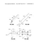 SPINAL IMPLANTS AND METHODS diagram and image