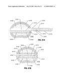 SPINAL IMPLANTS AND METHODS diagram and image