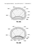 SPINAL IMPLANTS AND METHODS diagram and image