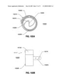 SPINAL IMPLANTS AND METHODS diagram and image