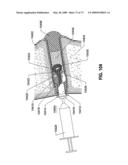 SPINAL IMPLANTS AND METHODS diagram and image