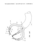 APPARATUS SYSTEMS AND METHODS FOR FORMING A WORKING PLATFORM OF A ROBOTIC INSTRUMENT SYSTEM BY MANIPULATION OF COMPONENTS HAVING CONTROLLABLY RIGIDITY diagram and image