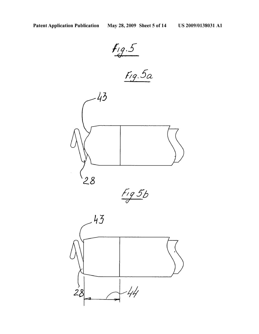 Thrombectomy catheter with a helical cutter - diagram, schematic, and image 06