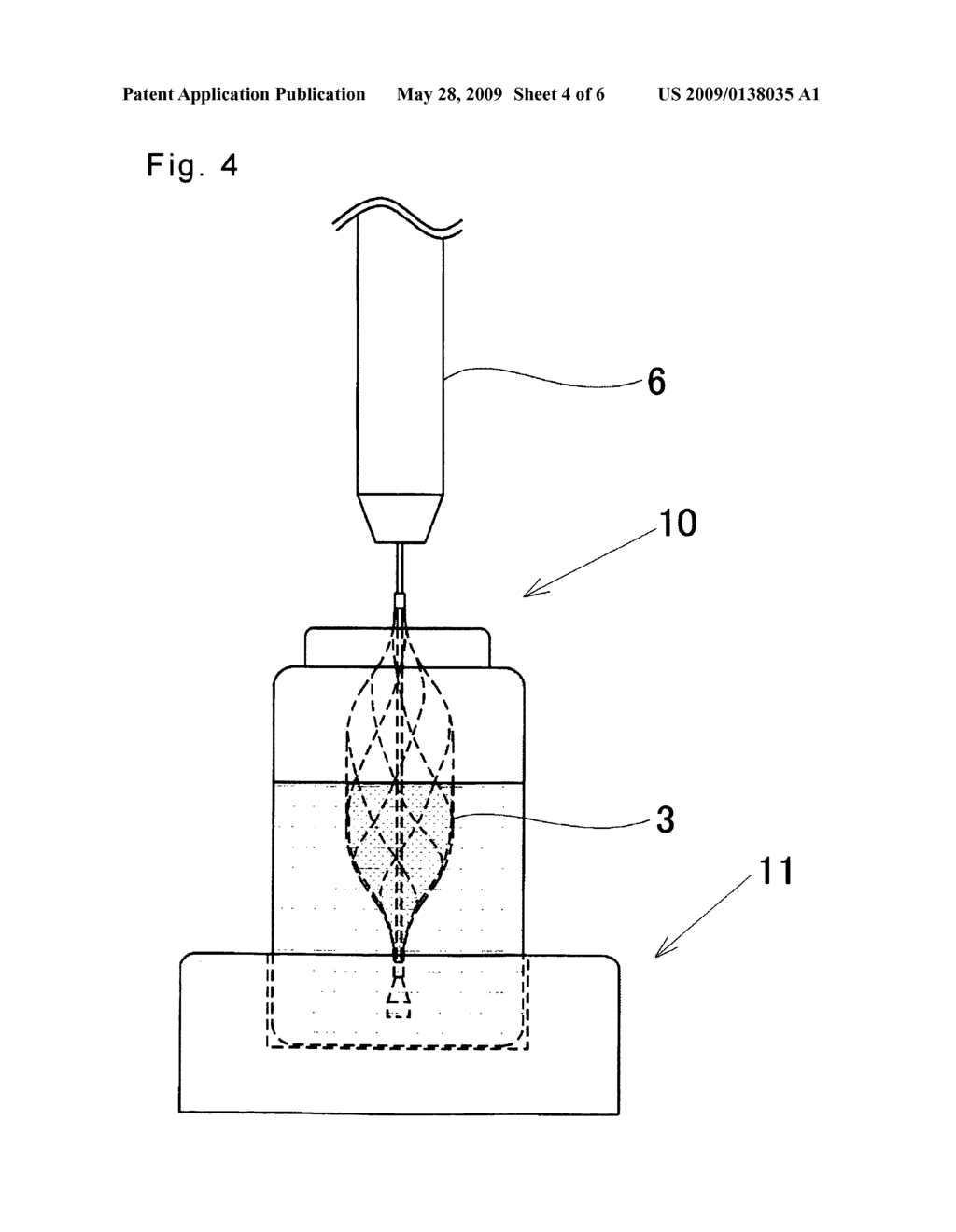 Filter for Thrombus Capture Catheter - diagram, schematic, and image 05