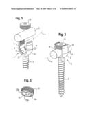 BONE ANCHORING DEVICE diagram and image