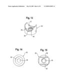 BONE ANCHORING DEVICE diagram and image