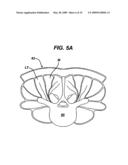 METHODS AND DEVICES FOR MINIMALLY INVASIVE SPINAL FIXATION ELEMENT PLACEMENT diagram and image