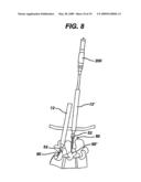 METHODS AND DEVICES FOR MINIMALLY INVASIVE SPINAL FIXATION ELEMENT PLACEMENT diagram and image