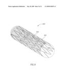 Stent Apparatuses for Treatment Via Body Lumens and Methods of Use diagram and image