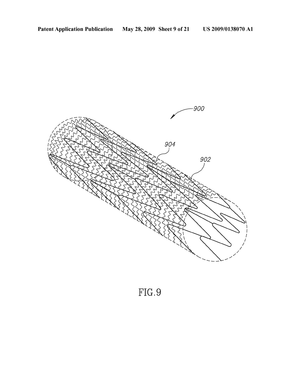 Stent Apparatuses for Treatment Via Body Lumens and Methods of Use - diagram, schematic, and image 10