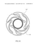 Stent Apparatuses for Treatment Via Body Lumens and Methods of Use diagram and image