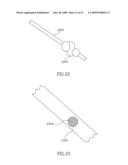 Stent Apparatuses for Treatment Via Body Lumens and Methods of Use diagram and image