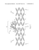 Bifurcated Stent with Drug Wells for Specific Ostial, Carina, and Side Branch Treatment diagram and image