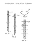 Universal fencing stake diagram and image