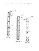 Universal fencing stake diagram and image