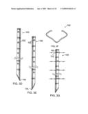 Universal fencing stake diagram and image