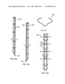 Universal fencing stake diagram and image