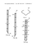 Universal fencing stake diagram and image