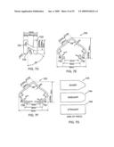 Universal fencing stake diagram and image