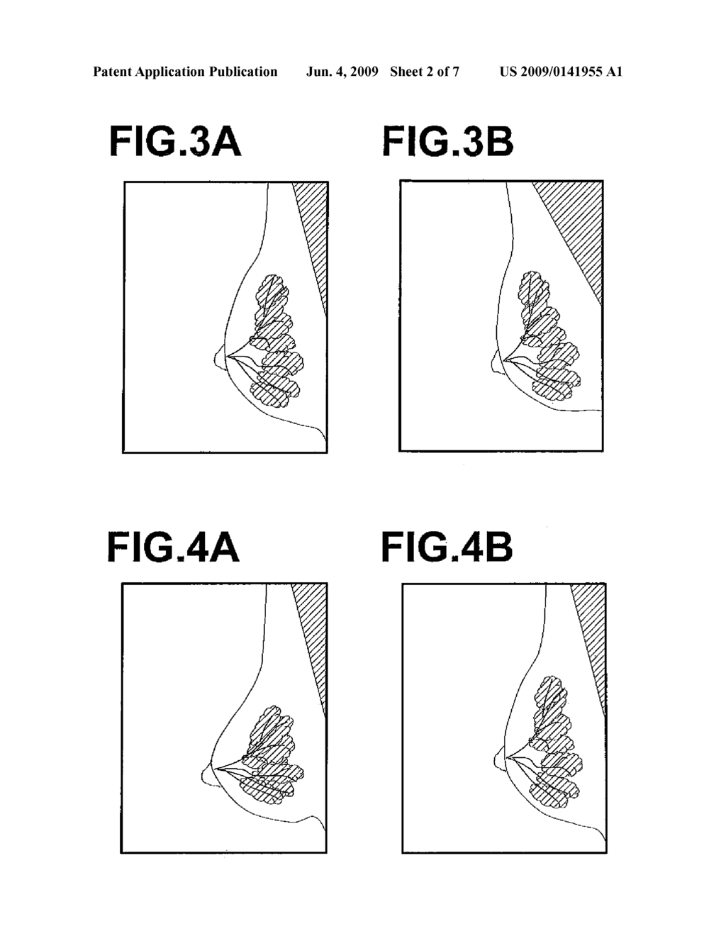 IMAGE PROCESSING APPARATUS AND PROGRAM FOR THE SAME - diagram, schematic, and image 03