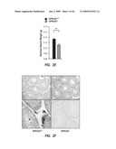 METHODS FOR TREATING A DISORDER BY REGULATING GPRC6A diagram and image