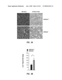 METHODS FOR TREATING A DISORDER BY REGULATING GPRC6A diagram and image