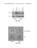 METHODS FOR TREATING A DISORDER BY REGULATING GPRC6A diagram and image