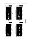 Activin-actriia antagonists and uses for promoting bone growth in cancer patients diagram and image