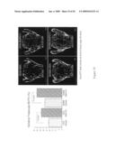 Activin-actriia antagonists and uses for promoting bone growth in cancer patients diagram and image