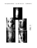 ORGAN REGENERATION DEVICE diagram and image