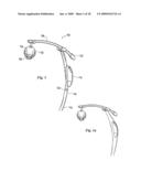 ILLUMINATION SYSTEM FOR DENTISTRY APPLICATIONS diagram and image