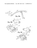 ILLUMINATION SYSTEM FOR DENTISTRY APPLICATIONS diagram and image