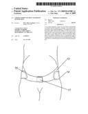 Lower uterine segment maternity support belt diagram and image